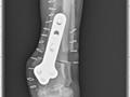X-ray